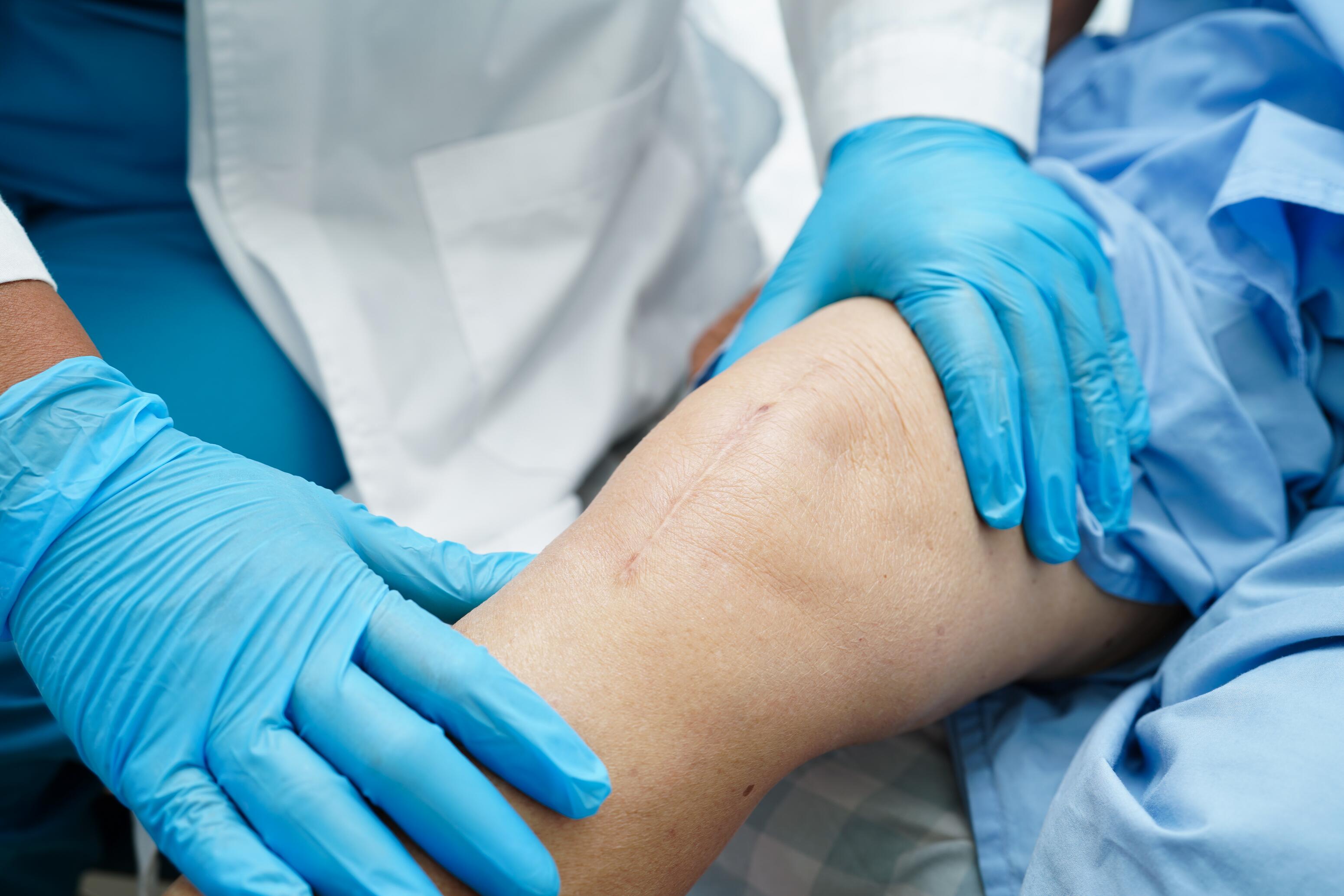 consulter un médecin pour une cicatrice